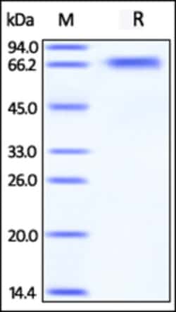 ACROBiosystems ACROBiosystems Human BACE-1 Protein, Tag Free (active enzyme,