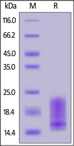 ACROBiosystems Biotinylated Human BAFFR / TNFRSF13C Protein, His,Avitag | Buy Online | ACROBiosystems | Fisher Scientific