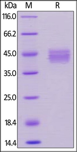ACROBiosystems ACROBiosystems Human BCMA / TNFRSF17 Protein, Llama IgG2b