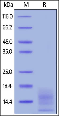 ACROBiosystems ACROBiosystems FITC-Labeled Human BCMA / TNFRSF17 Protein,