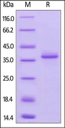 ACROBiosystems ACROBiosystems Mouse BCMA / TNFRSF17 Protein, Fc Tag, Quantity: