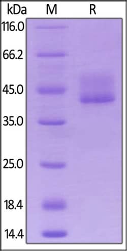 ACROBiosystems ACROBiosystems Biotinylated Mouse BCMA / TNFRSF17 Protein,