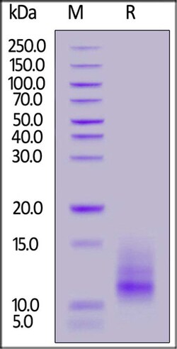 ACROBiosystems ACROBiosystems Rat BCMA / TNFRSF17 Protein,His Tag, Quantity: