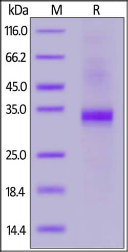 ACROBiosystems ACROBiosystems Biotinylated Human BLAME / SLAMF8 Protein,