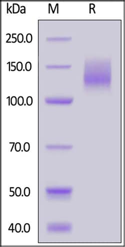 ACROBiosystems Biotinylated Human CA125 / MUC16 (13810-14451) Protein,