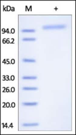 ACROBiosystems ACROBiosystems Human Cadherin-6 / KCAD / CDH6 Protein, His