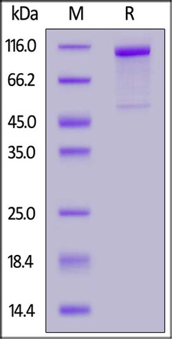 ACROBiosystems ACROBiosystems Human Cadherin-6 / KCAD / CDH6 Protein, Fc