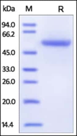 ACROBiosystems Recombinant Protein;Human Carbonic Anhydrase IX / CA9 (38-414)