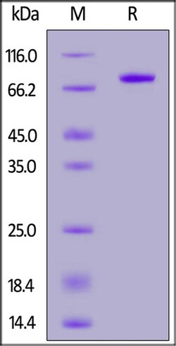 ACROBiosystems ACROBiosystems Human Carbonic Anhydrase IX / CA9 (38-414)