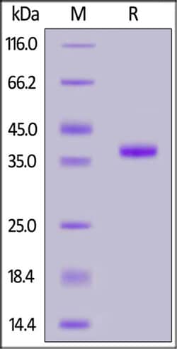 ACROBiosystems ACROBiosystems Human CCL5/RANTES Protein, Fc Tag (MALS verified),