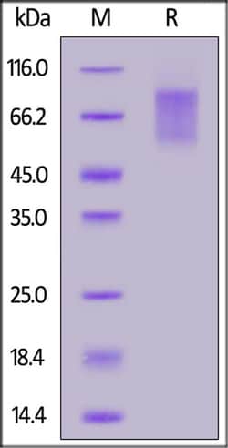 ACROBiosystems Human CD30 / TNFRSF8 Protein, His Tag, Quantity: Each of