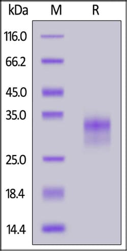 ACROBiosystems ACROBiosystems Rabbit CD40 / TNFRSF5 Protein, His Tag (MALS