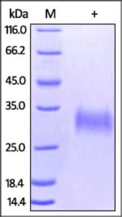ACROBiosystems Recombinant Protein;Human Fc gamma RIIA / CD32a (H167) Protein