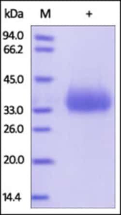 ACROBiosystems ACROBiosystems Human CD2 / SRBC Protein, His Tag, Quantity: