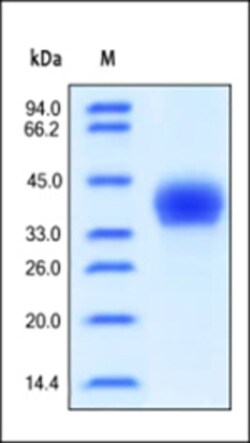 ACROBiosystems ACROBiosystems Human CD23 / Fc epsilon RII Protein, His