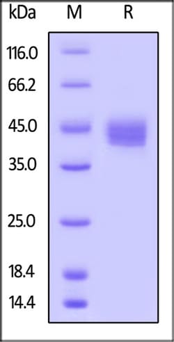ACROBiosystems ACROBiosystems Biotinylated Human CD23 / Fc epsilon RII