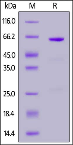 ACROBiosystems ACROBiosystems Sus scrofa CD73 / NT5E Protein, His Tag,