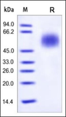 ACROBiosystems ACROBiosystems Human CD55 / DAF Protein, His Tag, Quantity: