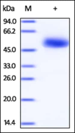 ACROBiosystems Recombinant Protein;Human CD5 Protein;HEK293;100UG;CD5,CD5,LEU1,LEU-1,