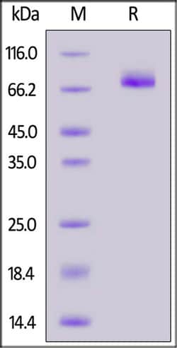 ACROBiosystems ACROBiosystems Mouse CD36 / SR-B3 Protein, His Tag, Quantity: