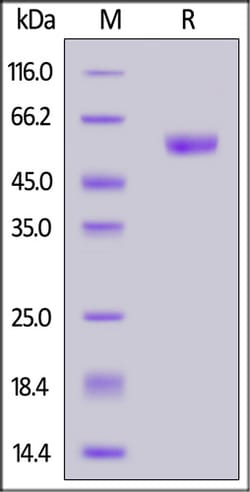 ACROBiosystems ACROBiosystems Human CD7 Protein, Fc Tag (MALS verified),
