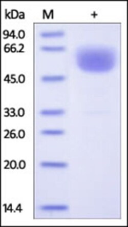 ACROBiosystems ACROBiosystems Human EMMPRIN / CD147 Protein, Fc Tag, Quantity:
