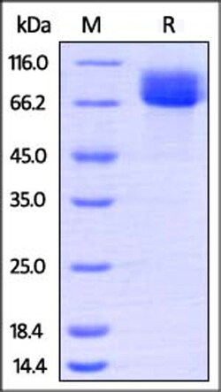ACROBiosystems ACROBiosystems Human CD117 / c-kit Protein, His Tag, Quantity: