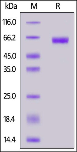 ACROBiosystems ACROBiosystems Biotinylated Human CD47 Protein, Mouse IgG2a