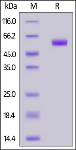 ACROBiosystems ACROBiosystems Biotinylated Human CD7 Protein, Fc,Avitag