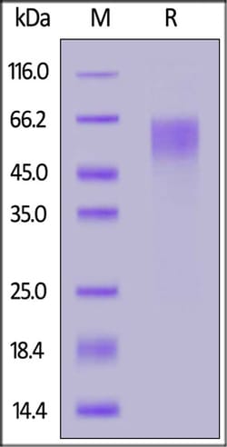 ACROBiosystems Cynomolgus / Rhesus macaque CD19 (20-292) Protein, His Tag,