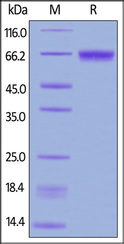 ACROBiosystems ACROBiosystems Human CD229 / SLAMF3 Protein, His Tag, Quantity: