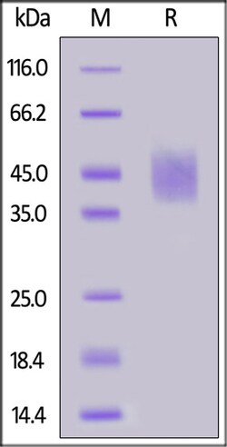ACROBiosystems ACROBiosystems Human CD89 / FCAR Protein, His Tag, Quantity:
