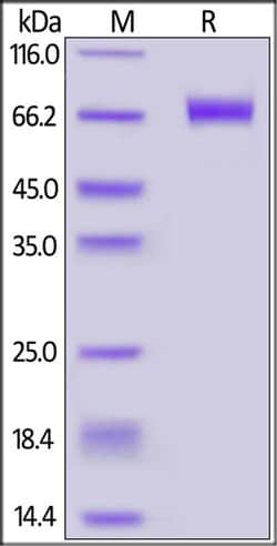 ACROBiosystems Biotinylated Human CD39 / ENTPD1 Protein, His,Avitag (MALS