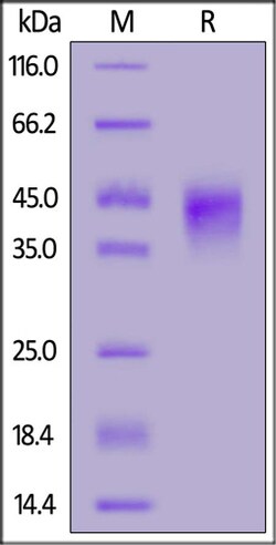 ACROBiosystems ACROBiosystems Rat Fc gamma RIIA / CD32a Protein, His Tag,