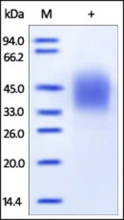 ACROBiosystems Recombinant Protein;Human Fc gamma RIIIB / CD16b (NA2) Protein