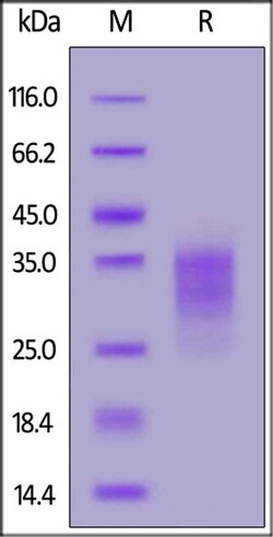 ACROBiosystems ACROBiosystems Biotinylated Human CD79B Protein, His,Avitag
