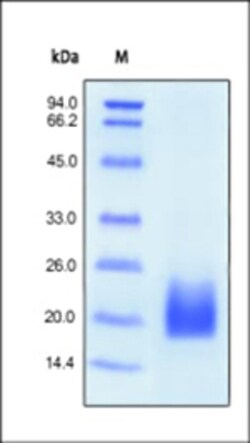 ACROBiosystems ACROBiosystems Human CD3 delta Protein, His Tag, Quantity: