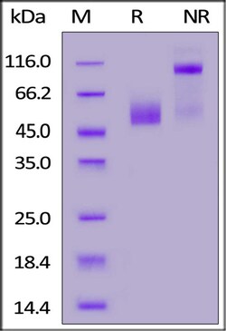 ACROBiosystems ACROBiosystems Human CD3 epsilon&CD3 delta Heterodimer Protein,