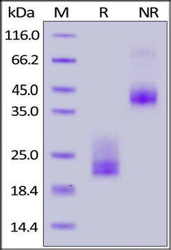 ACROBiosystems RECOMBINANT PROTEIN 25UG BIOTI, Quantity: Each of 1