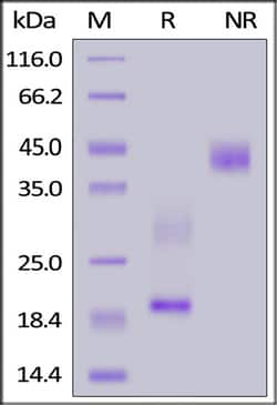 ACROBiosystems ACROBiosystems Rat CD3 epsilon&CD3 delta Heterodimer Protein,