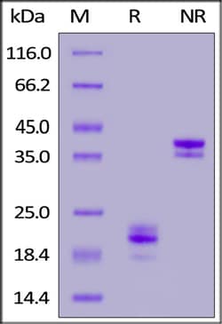 ACROBiosystems ACROBiosystems Biotinylated Rabbit CD3 epsilon &Flag Tag