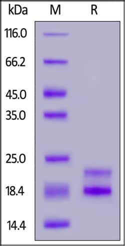 ACROBiosystems Rabbit CD3 epsilon&CD3 gamma Heterodimer Protein, His Tag&Flag