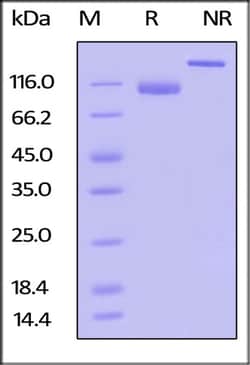 ACROBiosystems ACROBiosystems Biotinylated Human LILRB1 / CD85j / ILT2