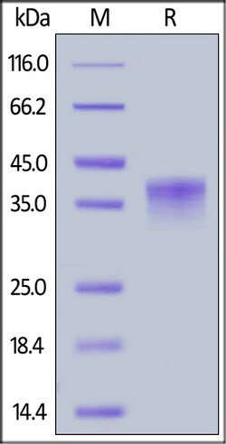 ACROBiosystems ACROBiosystems Cynomolgus LILRB4 / CD85k / ILT3 Protein,