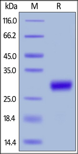 ACROBiosystems ACROBiosystems Mouse CD27 Ligand / CD70 Protein, His Tag