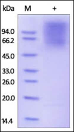 ACROBiosystems Recombinant Protein;Human CEACAM-1 / CD66a Protein;HEK293;100UG;CE1,CEACAM1,CD66a,BGP,BGP1,BGP-1,BGPI,