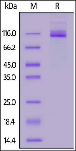 ACROBiosystems ACROBiosystems Mouse CEACAM-5 Protein, His Tag, Quantity: