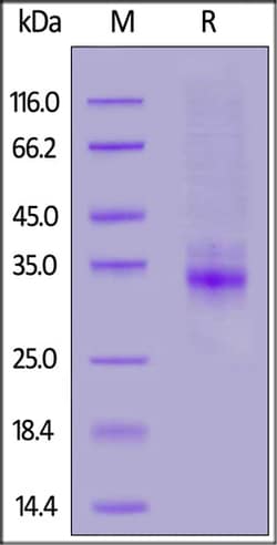 ACROBiosystems Mouse CLEC12A / MICL / CLL-1 Protein, His Tag, Quantity: