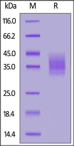 ACROBiosystems ACROBiosystems Rat CLEC12A / MICL / CLL-1 Protein, His Tag,