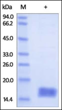 ACROBiosystems ACROBiosystems Human Cystatin SA / CST2 Protein, His Tag,
